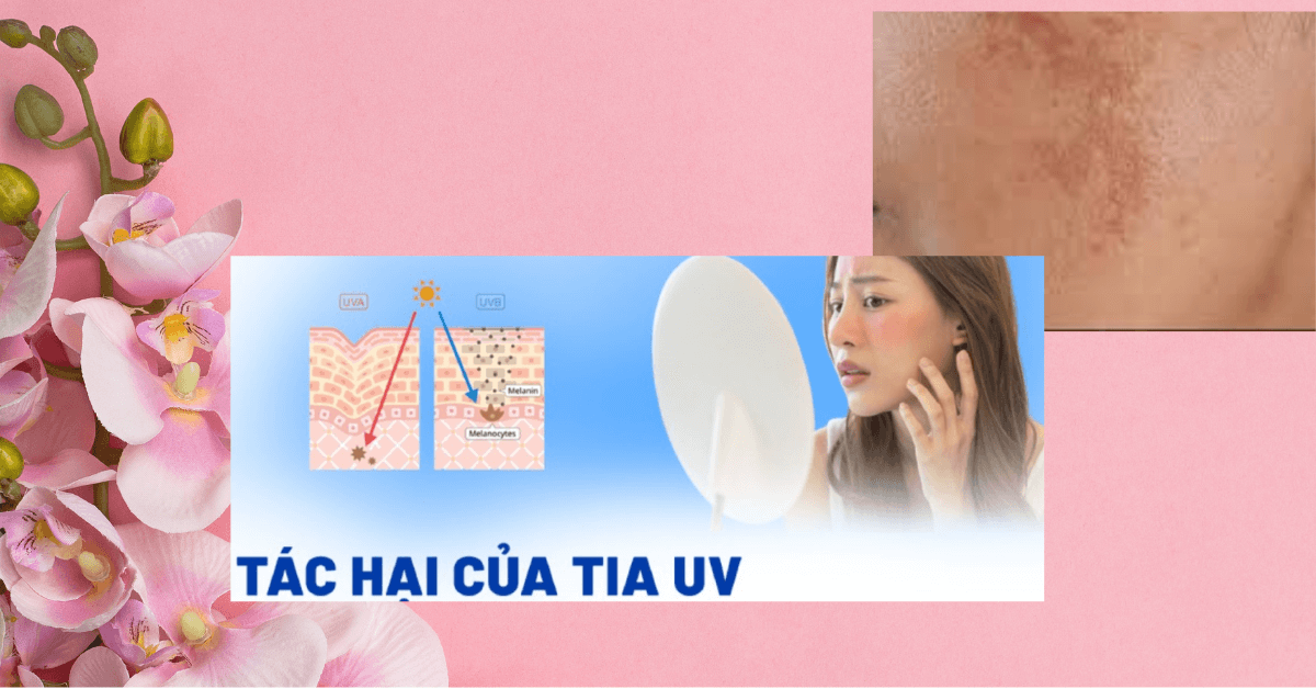 8 Bí Quyết Trị Da Sạm Tối Màu Hiệu Quả