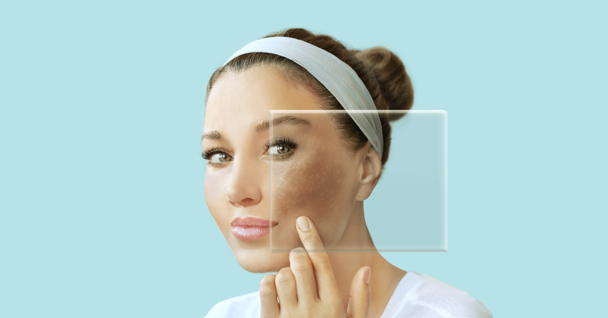 Bật Mí 5 Lợi Ích của Nubio cho Da Dầu Mụn