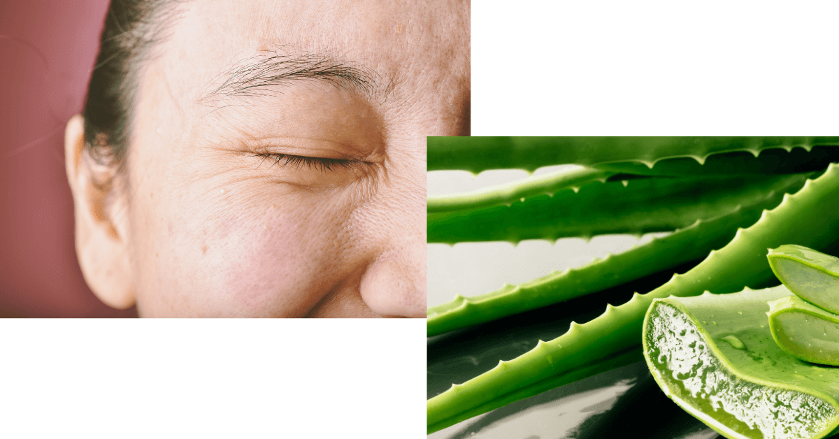 Hướng dẫn đầy đủ để điều trị sạm nám da