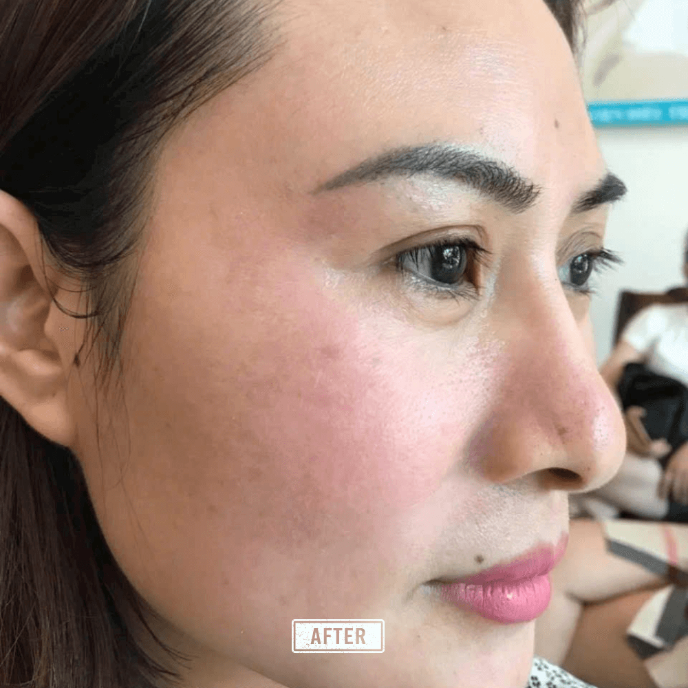 Ha Phạm Beauty - Dược sĩ làn da (1)