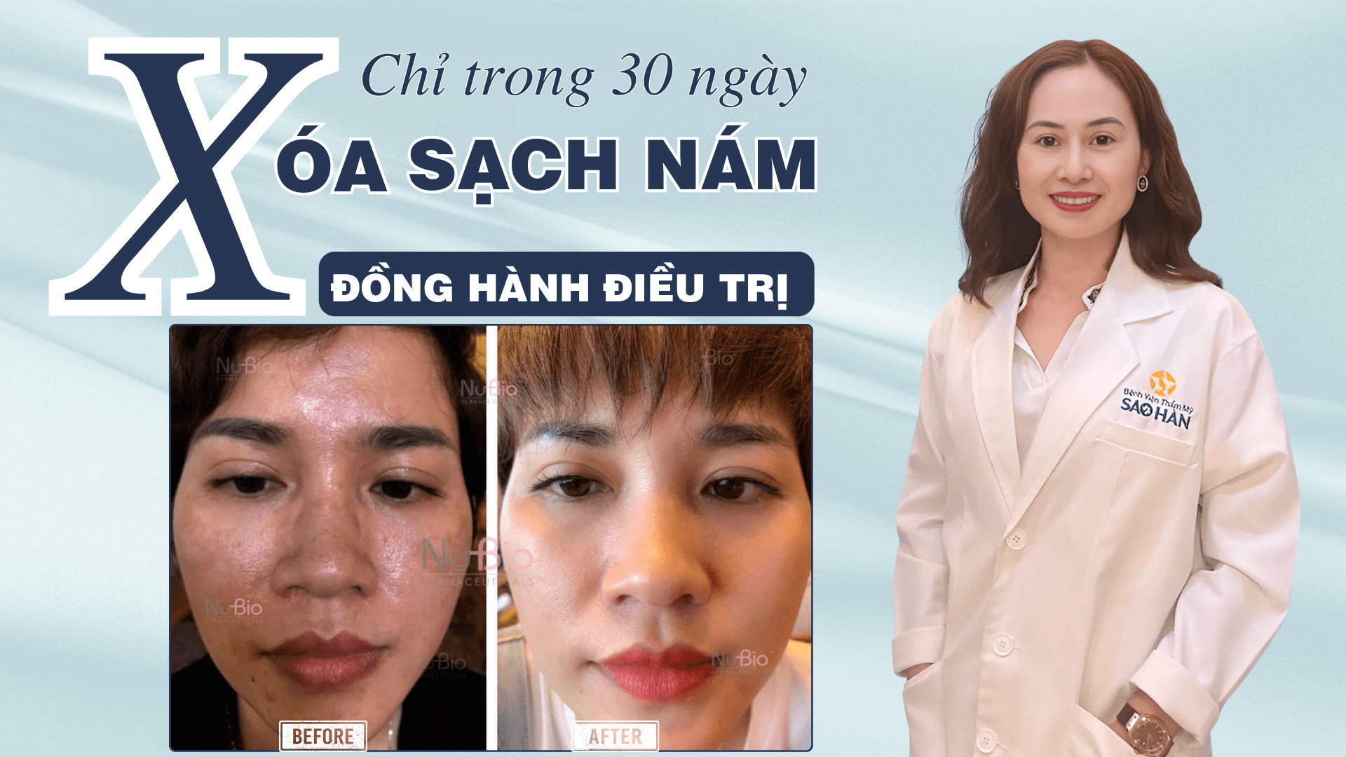 Dược sĩ Hà Phạm - điều trị nám da