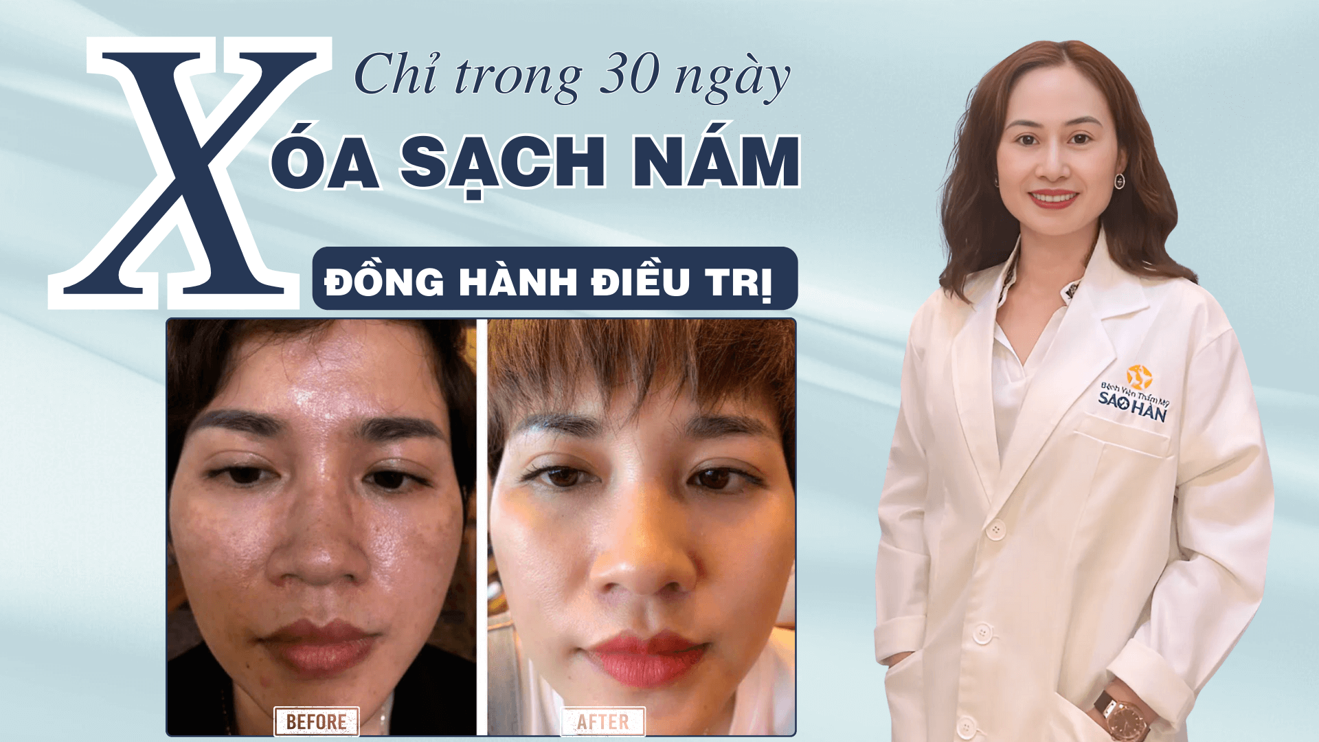 Dược sĩ Hà Phạm điều trị nám