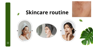 Tại Sao Da Bị Nám và Cách Khắc Phục Hiệu Quả - hình đại diện